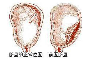 症状描述