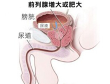 症状描述