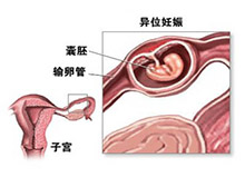 症状描述