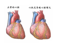 如何预防