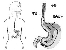 症状诊断/鉴别