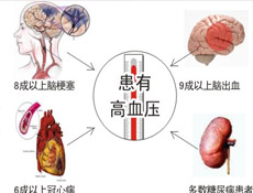 疾病简介