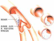 症状起因