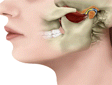 颞下颌关节紊乱综合征是口腔颌面部常见的疾病之一,在颞下颌关节疾病