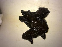 症状起因