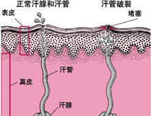 症状诊断/鉴别