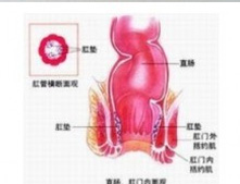 症状描述