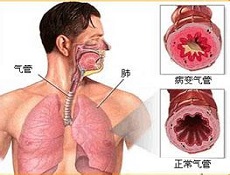 临床表现