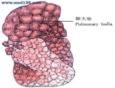 预防