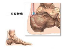 诊断