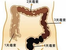 小儿便秘