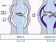 随访指导