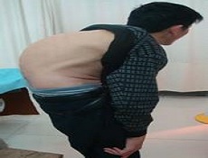 发病原因