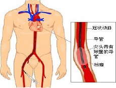 疾病治疗