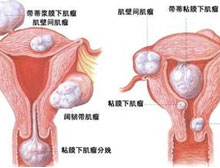 症状描述