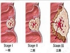 控制措施