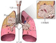 疾病治疗