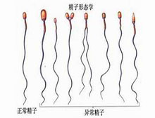 症状起因