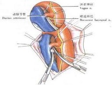 大动脉转位