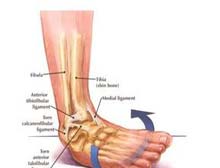 内踝下区域疼痛肿胀怎么回事_内踝下区域疼痛肿胀什么原因_内踝下区域