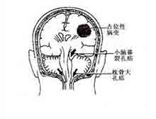 症状起因