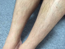 症状诊断/鉴别