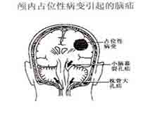 症状描述