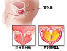 临床表现