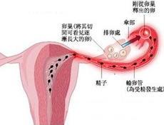 影响因素