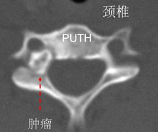 常见症状