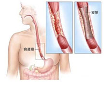 鉴别诊断