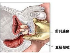 发病原因