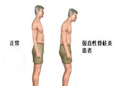 化验检查