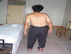 康复保健