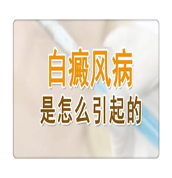 南京白癜风白癜风治疗医院？治疗过程中要注意哪些？