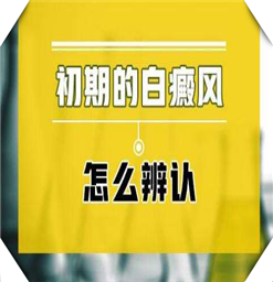 白癜风的症状表现你知道吗？白癜风医院选南京？