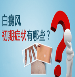 南京白癜风的治疗医院？ 如何在早期就发现白癜风？