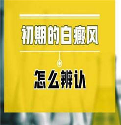 南京白癜风哪家医院好*诊断白斑有什么好方法