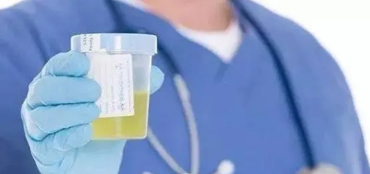 泡沫尿是你的肾脏出事了？