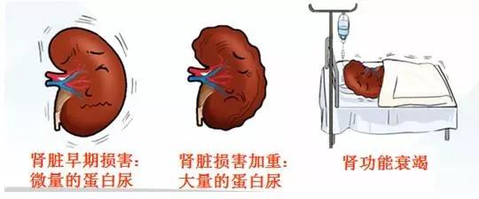 体检出现尿蛋白？