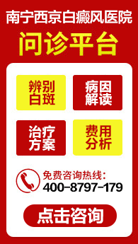 柳州哪家医院专业医院能治白癜风