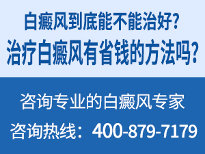 百色白癜风发作后需要做什么检查