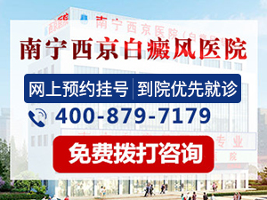 玉林白癜风去哪里治比较好
