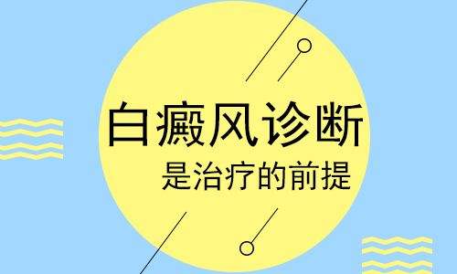 萍乡白癜风的诊断方式有哪些?