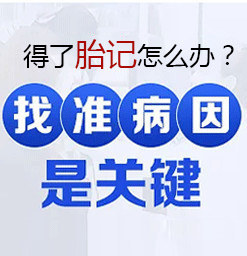江苏治太田痣医院哪家好？太田痣的一般表现是什么