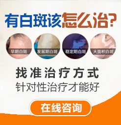沧州白癜风治疗好的医院？应该如何科学治疗白癜风？