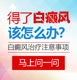 沧州白癜风治疗好的医院？为什么要定期复查白癜风呢？
