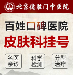 北京湿疹哪家医院