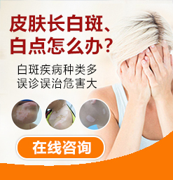 沧州得了白癜风去哪治疗？护理儿童白癜风需要怎样做？