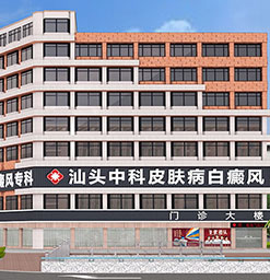 薄荷叶白癜风患友泡水能够去口臭吗